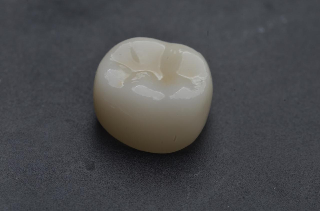 ZIRCONIA pediatric crown